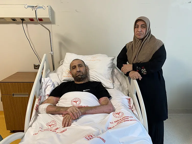 Mangal keyfi faciayla bitti! Vücudunun yüzde 80’i yandı: 10 ameliyat geçirdi...