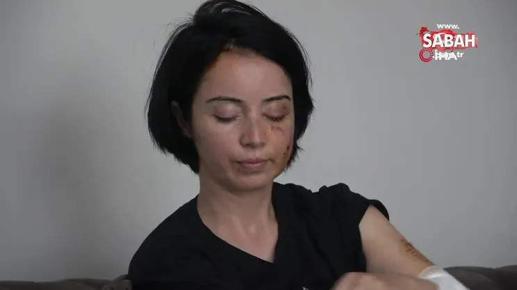 İki köpeğin saldırdığı anne-kız ucuz kurtuldu | Video