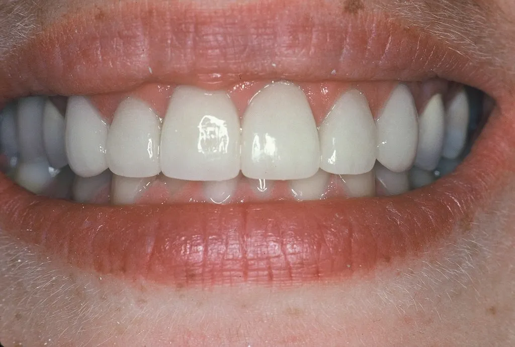 люминиры что это