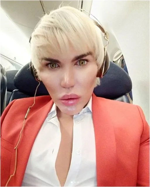 İşte Ken Bebek Rodrigo Alves'in estetiksiz hali