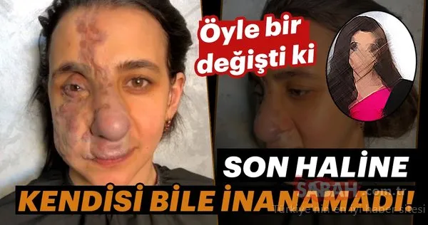 Öyle bir değişti ki....Son haline kendisi bile inanamadı!