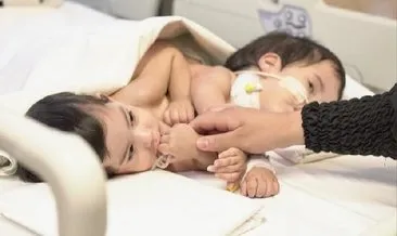 9 saat süren ameliyatla ayrılan Cezayirli bebeklerin durumu... #istanbul