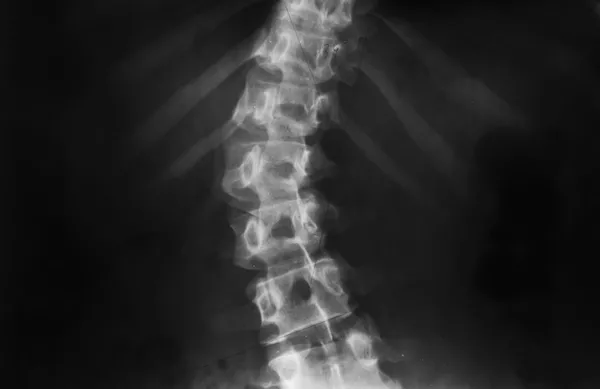 cocugunuzu-hemen-aynanin-karsisina-gecirin-sinsi-hastaligi-saniyeler-icinde-ele-veren-basit-test-1780468127434.jpg