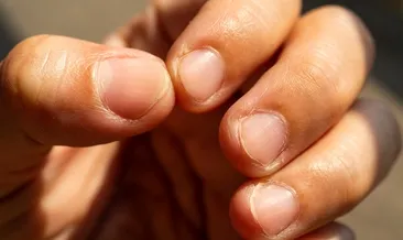 Uzmanlardan ’tırnak batması’ uyarısı