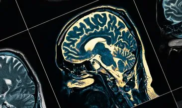 Yeni jenerasyon bilgisayar arayüz sistemi, beyinde yeni tedavilerin önünü açabilir