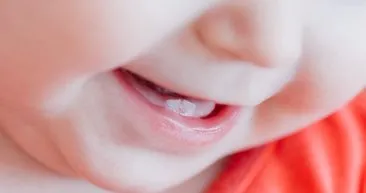 Bebeklerde görülen diş problemleri!