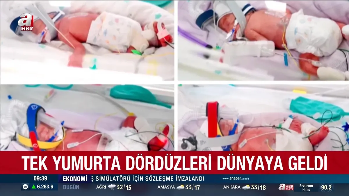 15 milyonda bir görülen mucize doğum: Tek yumurta dördüzleri dünyaya geldi | Video videosunu izle 15 milyonda bir görülen mucize doğum: Tek yumurta dördüzleri dünyaya geldi | Video videosunu izle