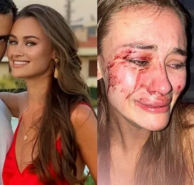 Son dakika: Darp edildiğini iddia eden Ukraynalı model Daria Kyryliuk ve erkek arkadaşı ifade verdi! Herif öldü ambulans çağırın...