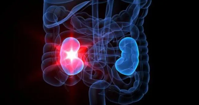 Böbrek Yetmezliği Belirtileri Nelerdir? Böbrek Yetmezliği Belirtileri Nasıl Anlaşılır ve Semptomları Neler?