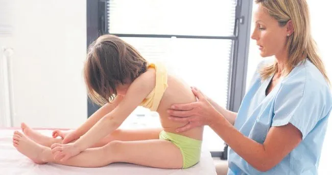 Sirtta Duzlesme Veya Kamburluk Skolyoz Belirtisi Son Dakika Haberler