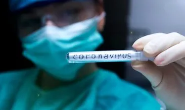 Son dakika! Coronavirüs tedavisi ile ilgili çok iddialı açıklama: Yüzde yüz etkili antikor geliştirdik...