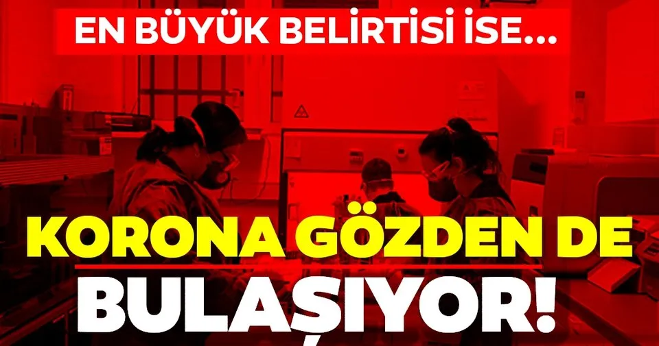goz hastaliklari uzmanindan son dakika corona virus uyarisi gozlerden de bulasiyor belirtileri ise saglik haberleri
