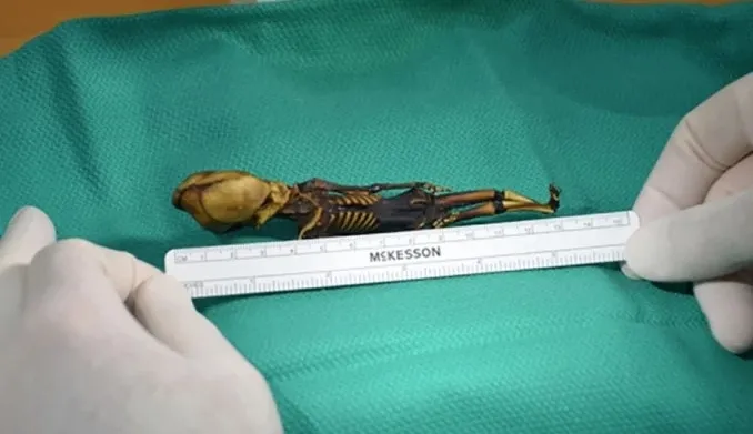 Kafatasının şekli akıllara tek bir şeyi getirmişti! Gizemli iskeletin sırrı çözüldü