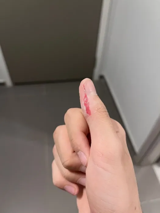 Okula giden 16 yaşındaki İhsan köpek saldırısına uğradı: Talihsiz çocuk canını zor kurtardı!