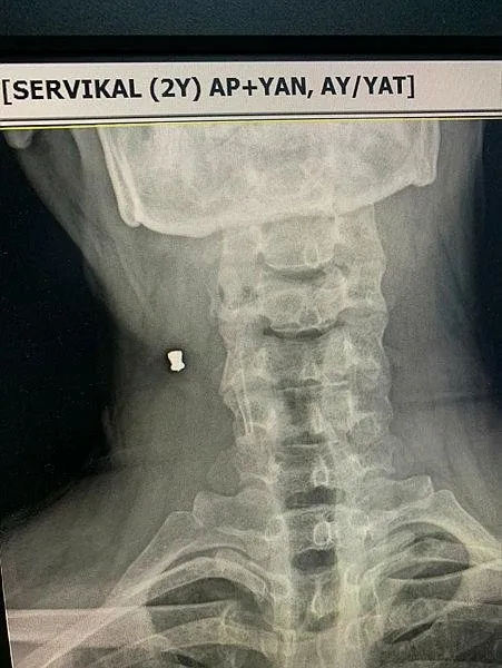 boynundaki havali tufek sacmasini 30