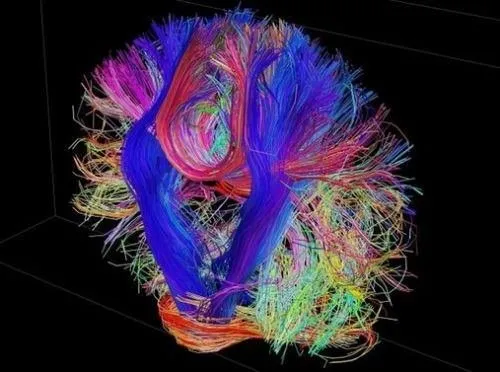 İnsan beyninin en detaylı görüntüleri