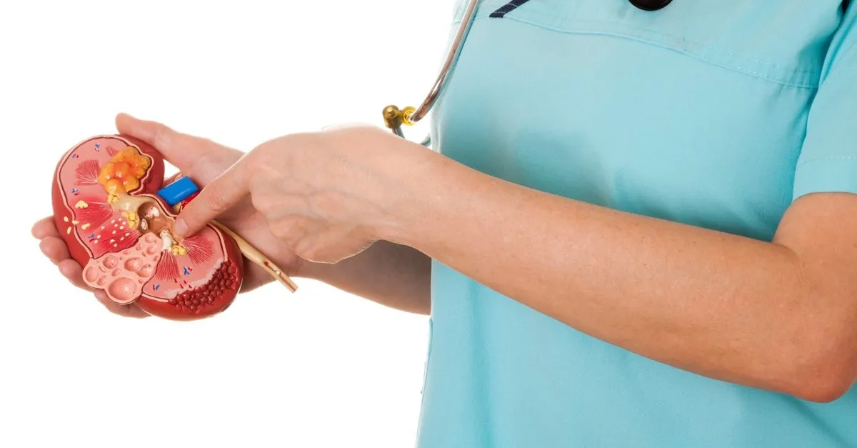 o besin bobrek tasina neden oluyormus