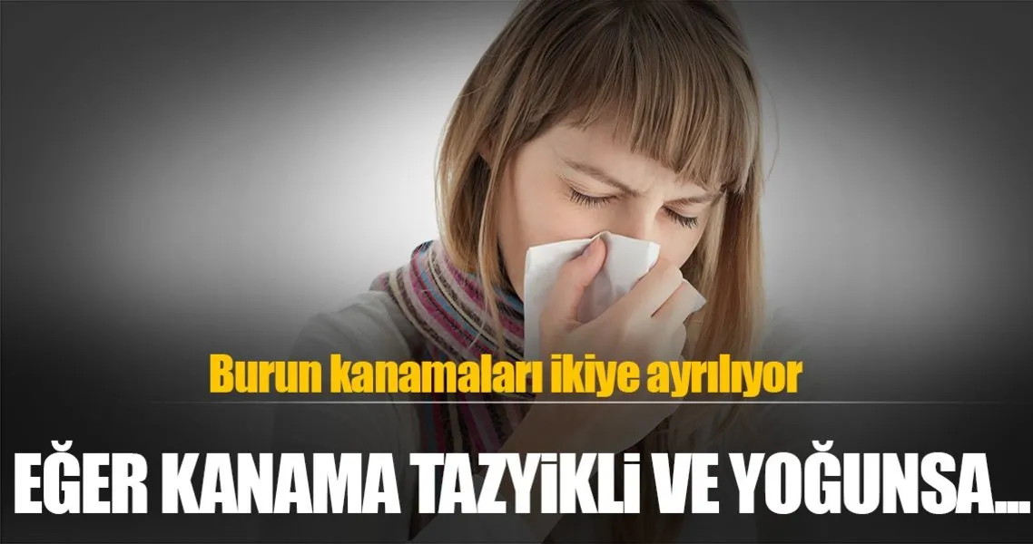 Burun Kanamasi Icin Ne Yapilmali Saglik Haberleri