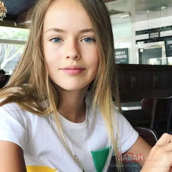 Dünyanın en güzel çocuÄu olarak görülüyordu! İÅte son hali