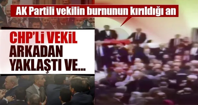 AK Partili Fatih Şahin’in burnu kırıldı