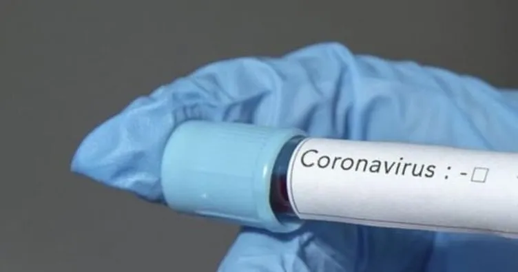 Polonya’da ilk koronavirüs teşhisi