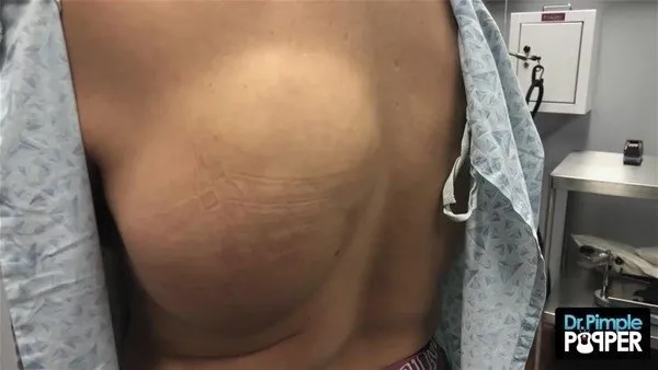 30 yıl boyunca baş ağrısı çekti! Sebebi kan dondurdu