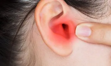 Orta kulak iltihabı iyileşme belirtileri nelerdir? Orta kulak iltihabı kaç günde geçer, iltihap ağrısına ne iyi gelir?