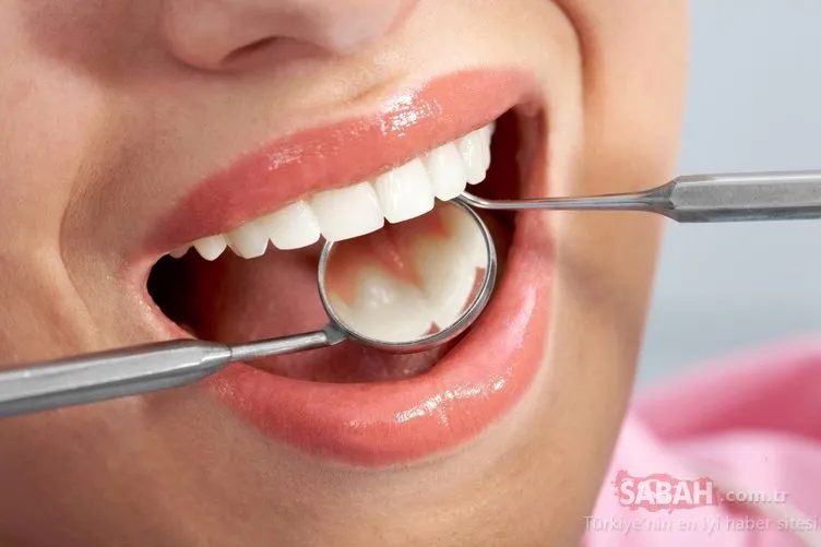 Diş çürüğüne engel olan besinler nelerdir? İşte diş çürüğüne son veren besinler