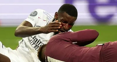 Real Madrid Şampiyonlar Ligi’nde son 16 turunda! Antonio Rüdiger bir anda kanlar içinde kaldı...