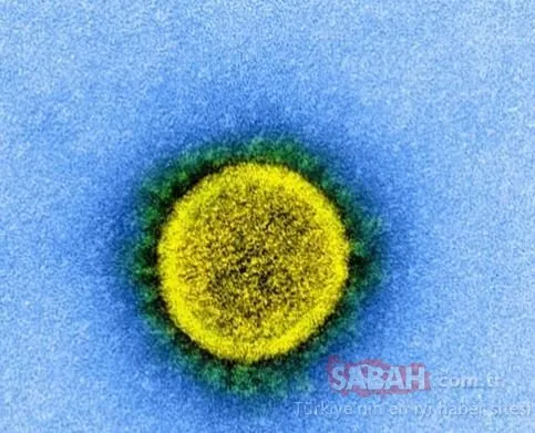 Son Dakika Haberi: ABD’li bilim insanları Coronavirüs’ü görüntüledi! Vücudu böyle etkisi altına alıyor...