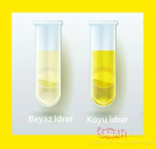 idrar renginiz ne anlama geliyor sayfa 6 saglik haberleri