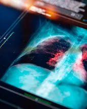 Elektronik sigara kullanımındaki korkunç tablo! Uzmanı uyardı: 5 yaşındaki çocuğun elinde gördüm