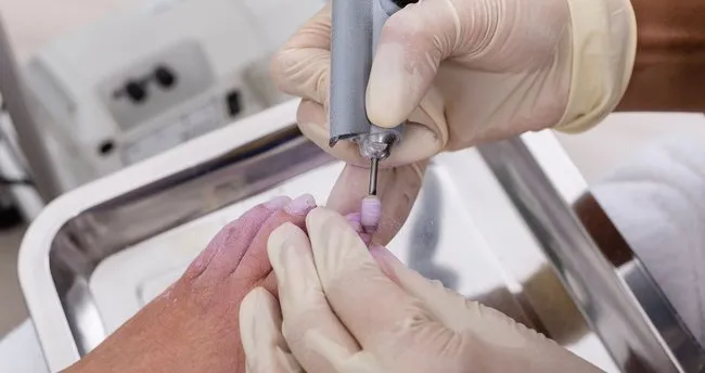 Medikal Ayak El Tirnak Bakimi Nedir Ve Neleri Kapsar Saglik Haberleri