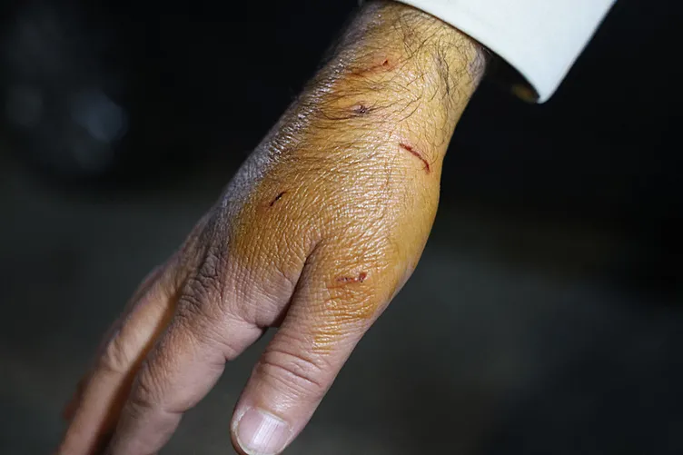 Diyarbakır’da bir sitede köpek dehşeti: 3 kişi yaralandı!