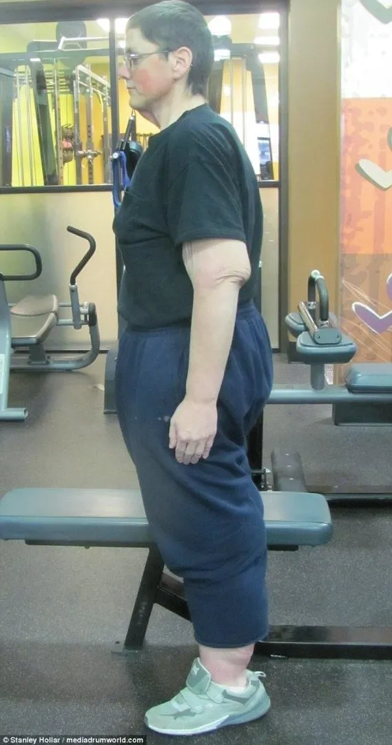 308 kiloydu! İnanılmaz değişim