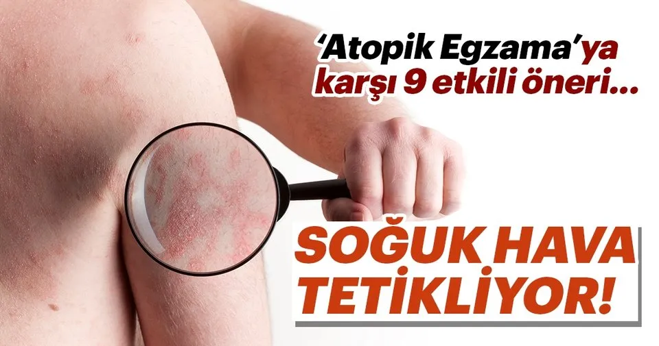 atopik egzama nedir neden olur atopik