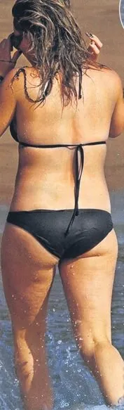 Selülitli güzeller