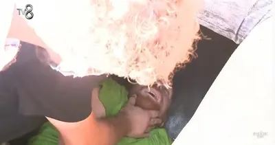 Survivor Furkan Kızılay sağlık durumu nasıl? 2022 Survivor yarışmacısı Furkan sakatlandı mı, ne oldu, sağlık durumu nasıl, yarışmadan ayrılacak mı?