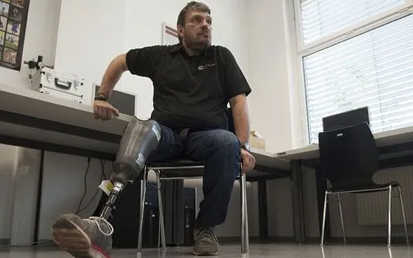 Dünyanın ilk 'hisseden protez' bacağı