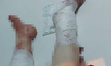 Annesini tüfekle vurmuştu! 17 yaşındaki genç tutuklandı #adana Annesini tüfekle vurmuştu! 17 yaşındaki genç tutuklandı #adana