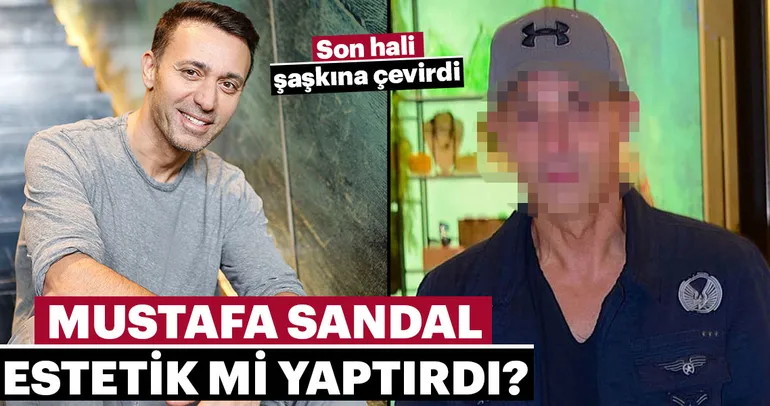 Estetik yaptıran ünlü isimler