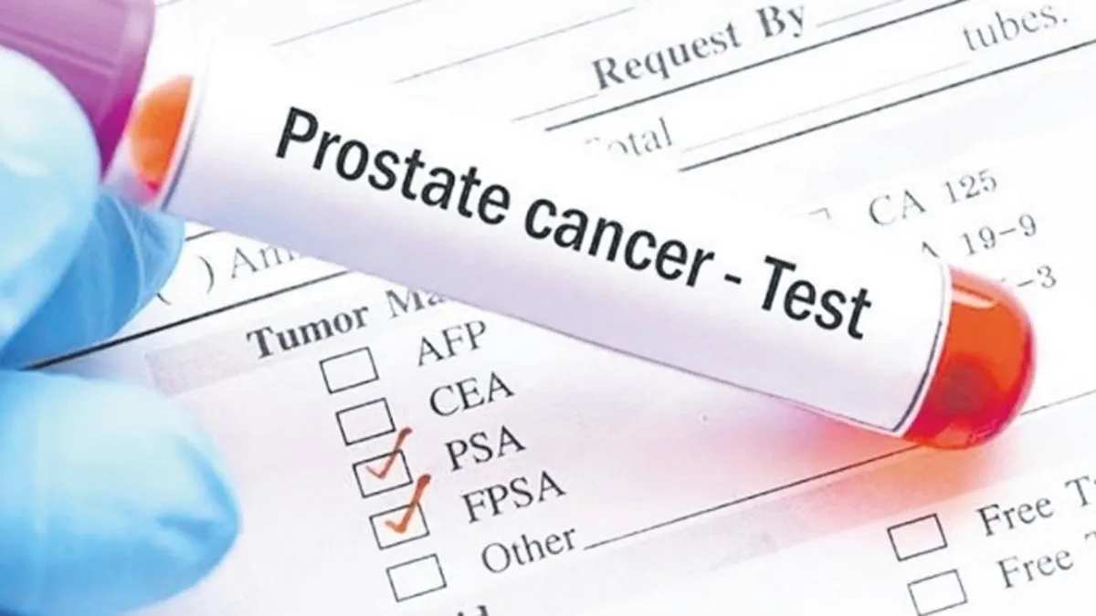 Prostat kanseri teşhisinde önemli gelişme