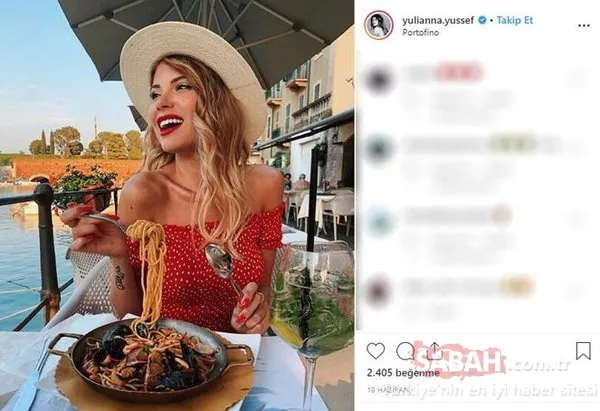 Cildi yüzünden herkes alay ediyordu... Şimdi dünya markaları peşinden koşuyor!