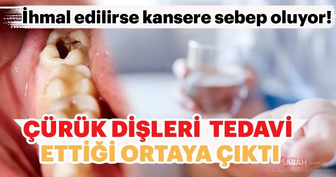 Dis Curumesi Ve Dis Cekimi Ile Alakali Okudukca Disinizi Agritacak Kadar Ilginc Bilgiler Onedio Com