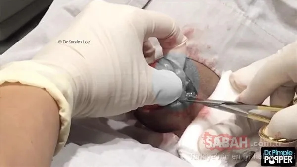 Doktora bu halde geldi! Sonrasındaysa...