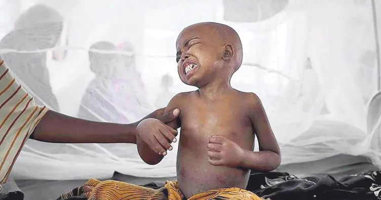 25 yılın en kötü kolera salgını