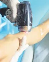 Lazer epilasyon dehşeti