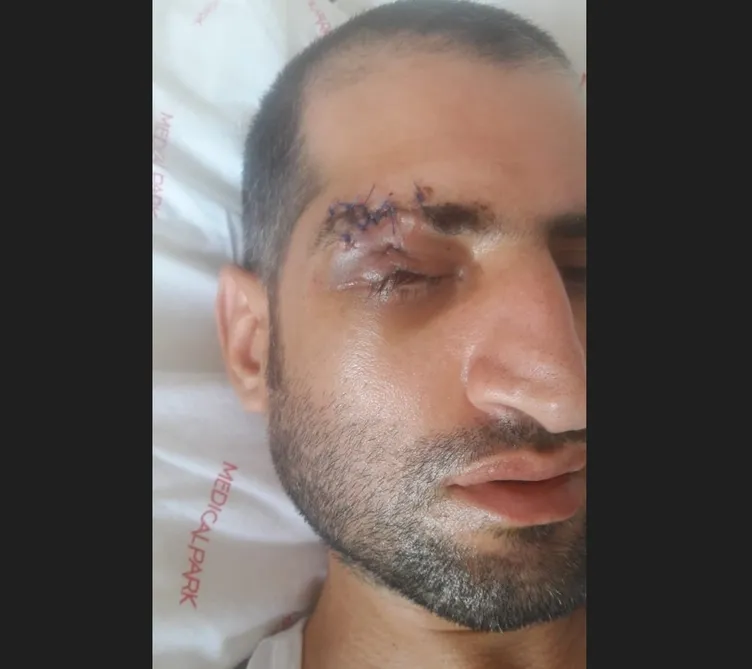 15 Temmuz gazisi İsmail Acur: Şehitlik bana şah damarımdan daha yakın! Hainlerin mermisi 7 yıldır boynunda