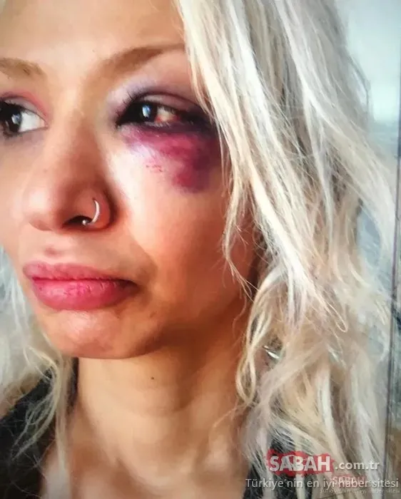 “Yüzyüzeyken Konuşuruz” solisti Can Tunaboylu’ya 1 yıl 9 ay hapis kararı! sevgilisi Aybike Çelik’i darbettiği iddiasıyla yargılanıyordu... 5 Yüzyüzeyken Konuşuruz solisti Can Tunaboylu’ya 1 yıl 9 ay hapis kararı! sevgilisi Aybike Çelik’i darbettiği iddiasıyla yargılanıyordu...