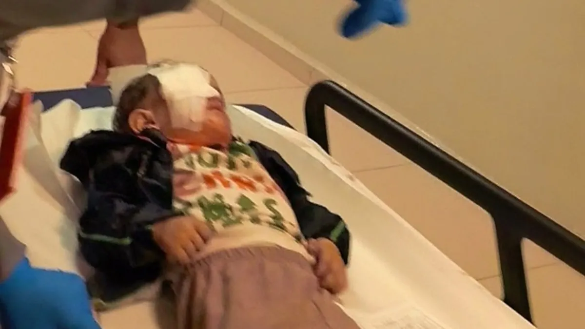 Bursa’da torpil faciası: 2 yaşındaki çocuğun gözüne isabet etti! Bursa’da torpil faciası: 2 yaşındaki çocuğun gözüne isabet etti!